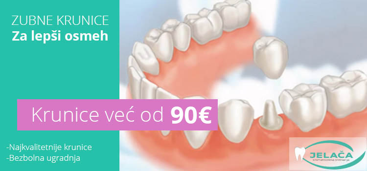 Zubne krunice cena - Novi Sad